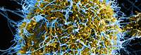 Mikroskopische Aufnahme eines Ebola Virus-Partikel